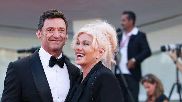 Hugh Jackman and Deborra-Lee Furness announce their separation after 27 years of marriage