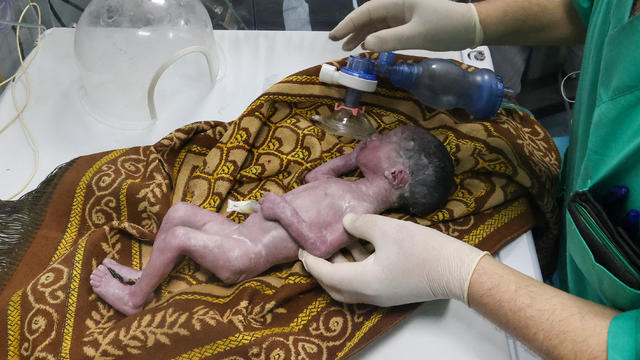 Gaza baby girl saved from dying mother's womb after Israeli airstrike dies just days later